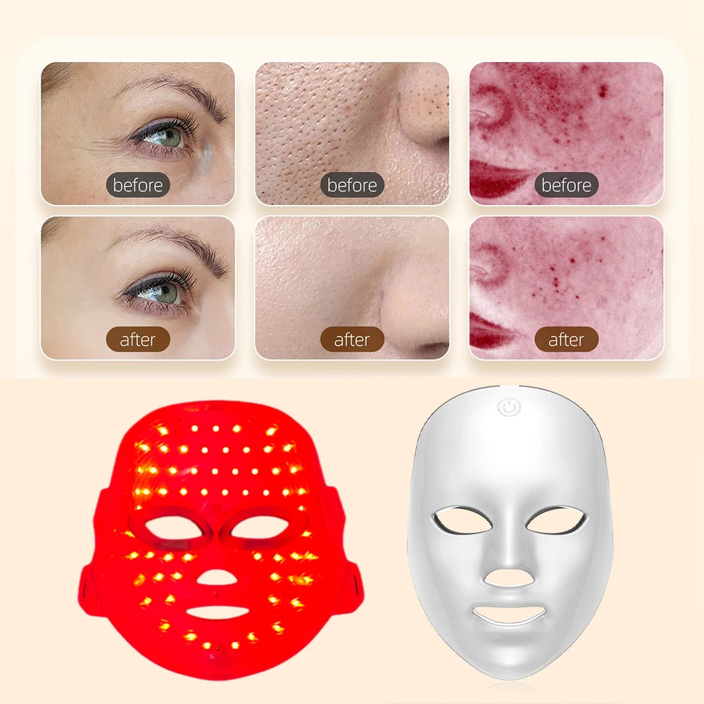 Aethera Rechargeable Facial LED Mask 7 Colors